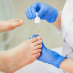 The role of a Podiatrist in managing diabetes