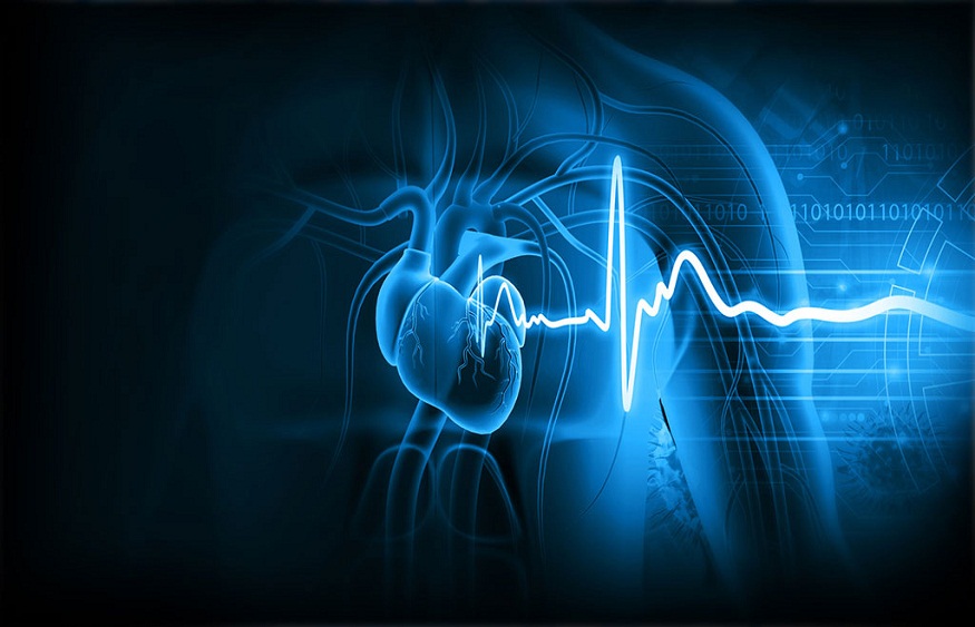 Detecting Cardiovascular Diseases