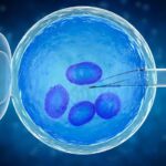 Preimplantation Genetic Diagnosis (PGD): A Conversation With A Specialist