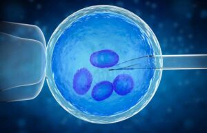 Preimplantation Genetic Diagnosis (PGD)