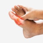 The Role Of Podiatrists In Preventing Foot Complications In Patients With Gout