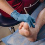 The Role Of Vascular Surgeons In Critical Limb Ischemia Treatment