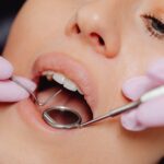 Dental restoration guide: 8 things you should know about implants